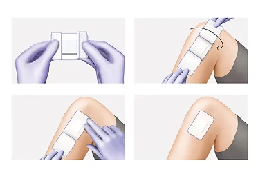 Cosmopor E 無菌自黏傷口敷料 7.2×5cm 50片|術後傷口護理貼