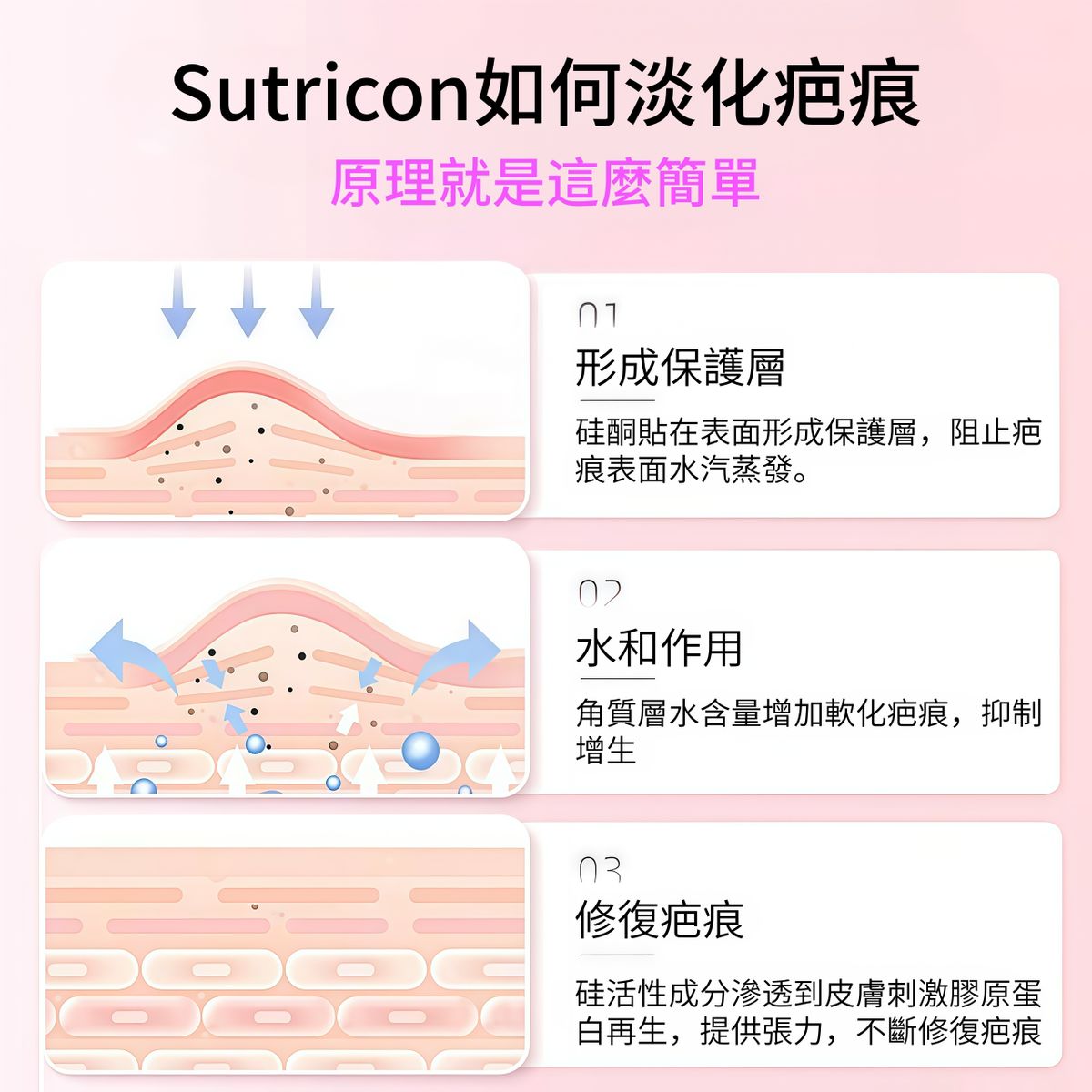 Sutricon 矽膠疤痕貼 3×10cm 5片裝 產品圖片 5